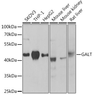 GALT Rabbit pAb
