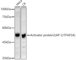 Activator protein 2 (AP-2/TFAP2A) Rabbit pAb