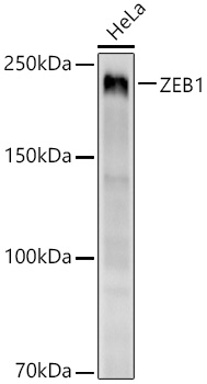 ZEB1 Rabbit mAb