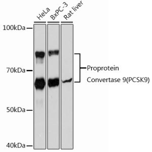 Proprotein Convertase 9(PCSK9) Rabbit mAb