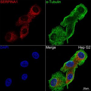 Alpha-1 Antitrypsin (SERPINA1) Rabbit mAb
