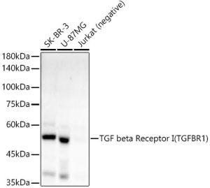 TGF beta Receptor I (TGFBR1) Rabbit mAb
