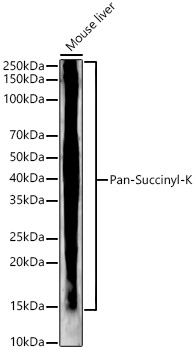 Pan-Succinyl-K Rabbit mAb