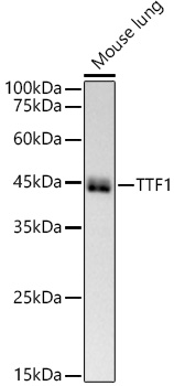 NKX2-1 Rabbit mAb