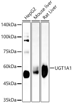 UGT1A1 Rabbit mAb