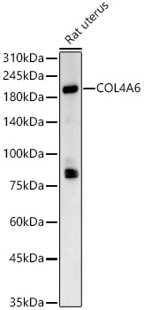 COL4A6 Rabbit pAb