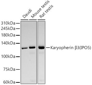 Karyopherin β3 (IPO5) Rabbit mAb