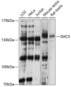 SMC5 Rabbit pAb