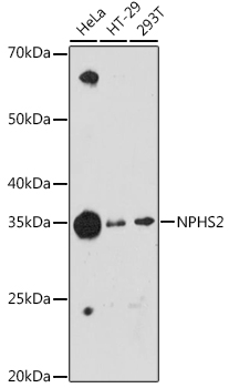 NPHS2 Rabbit mAb