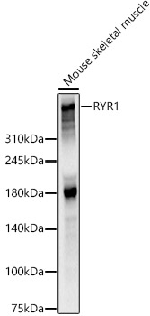 RYR1 Rabbit pAb