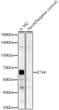 ETV4 Rabbit mAb