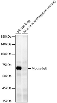 Mouse IgE Rabbit mAb