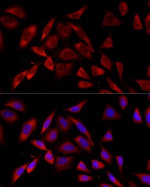 PKC alpha Rabbit mAb