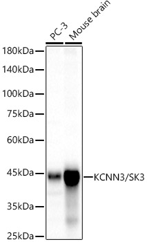 KCNN3/SK3 Rabbit mAb