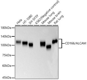 CD166/ALCAM Rabbit mAb