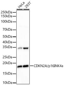 CDKN2A/p16INK4a Rabbit mAb