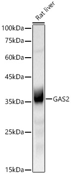 GAS2 Rabbit mAb