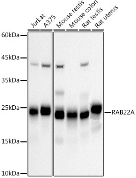 RAB22A Rabbit mAb