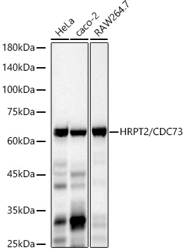 HRPT2 / CDC73 Rabbit mAb