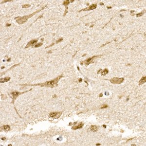 SOCS7 Rabbit mAb