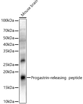 Progastrin-releasing  peptide Rabbit pAb