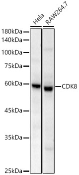 CDK8 Rabbit mAb