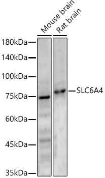 SLC6A4 Rabbit pAb