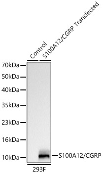 S100A12/CGRP Rabbit mAb