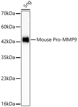 Pro-MMP9 Rabbit mAb