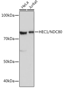 HEC1/NDC80 Rabbit mAb