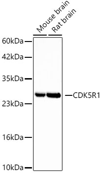 CDK5R1 Rabbit mAb
