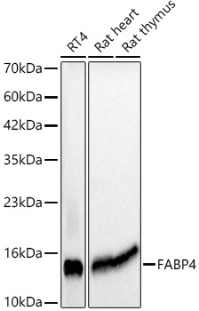 FABP4 Mouse mAb