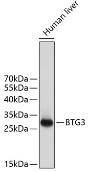 BTG3 Rabbit pAb