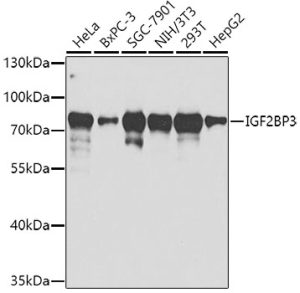 IGF2BP3 Rabbit pAb