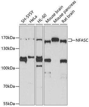 NFASC Rabbit pAb