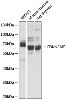 CDKN2AIP Rabbit pAb