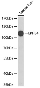 EPHB4 Rabbit pAb