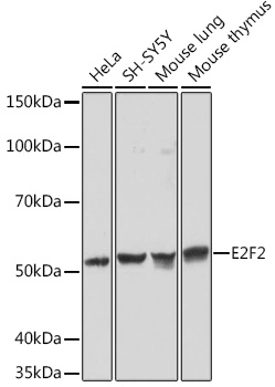 E2F2 Rabbit mAb