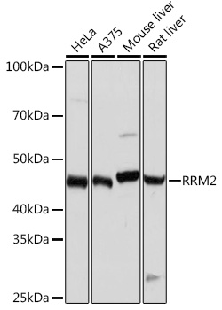RRM2 Rabbit mAb