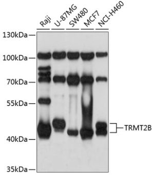 TRMT2B Rabbit pAb
