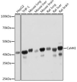 CaMKI Rabbit mAb