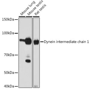 Dynein intermediate chain 1 Rabbit mAb