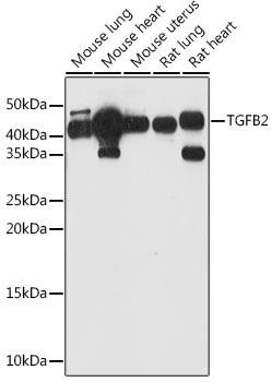 TGFB2 Rabbit pAb