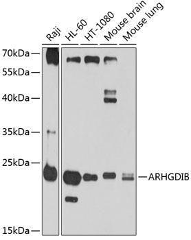 ARHGDIB Rabbit pAb