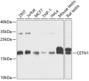 CETN1 Rabbit pAb