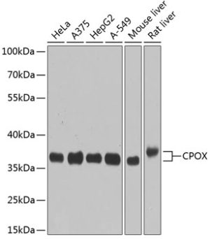 CPOX Rabbit pAb