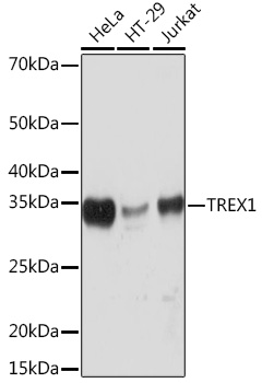 TREX1 Rabbit mAb