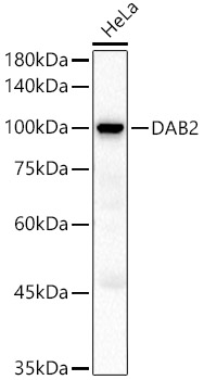 DAB2 Rabbit pAb