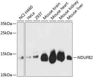 NDUFB2 Rabbit pAb