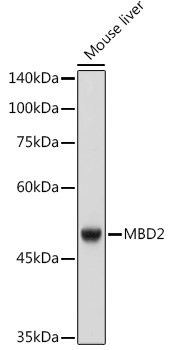 MBD2 Rabbit mAb